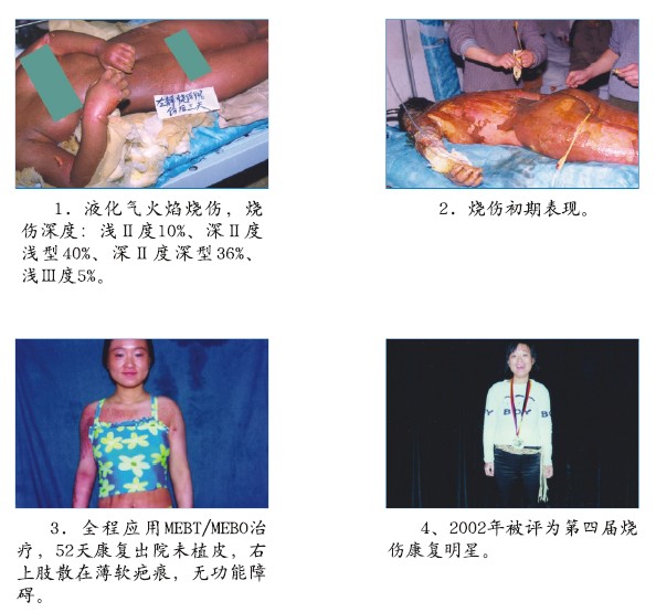 威客电竞(vkgame)-为竞技而生